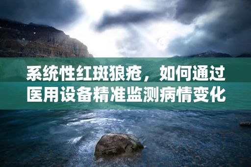 系统性红斑狼疮，如何通过医用设备精准监测病情变化？